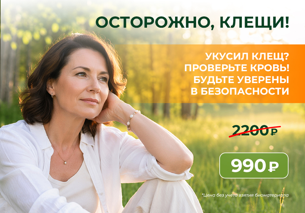 Клещи.jpg Клещи.jpg